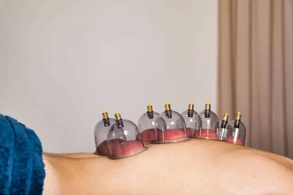 Lymphatic Drainage Treatment (Laser & Needle Acupuncture + Cupping) 1 Understanding the Lymphatic System