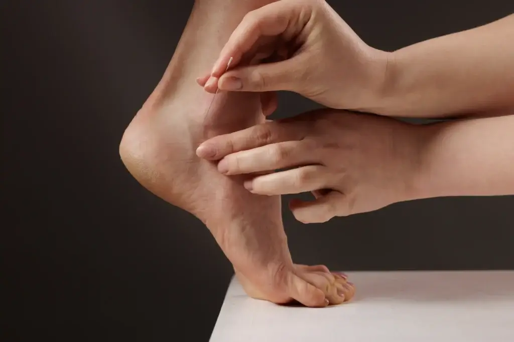 How Needle Acupuncture Works: The Science and Theory