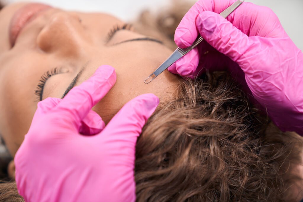Young woman is being cleaned with a special tool, dermatologist works in gloves
