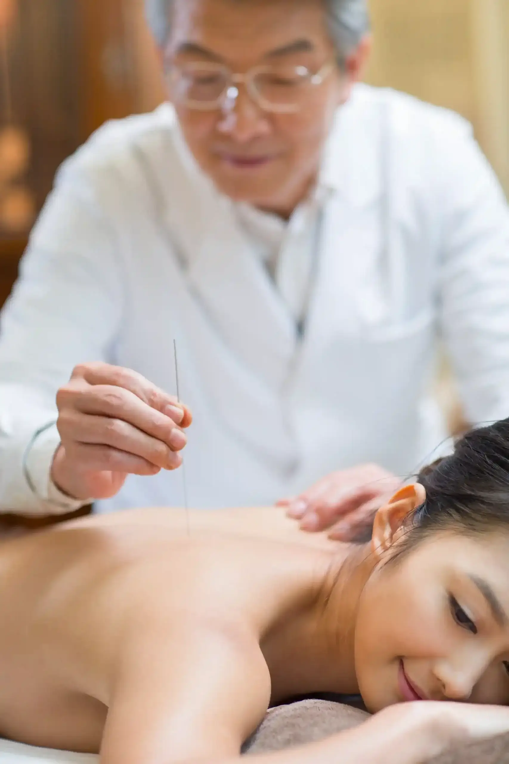 Acupuncture for Stress & Anxiety